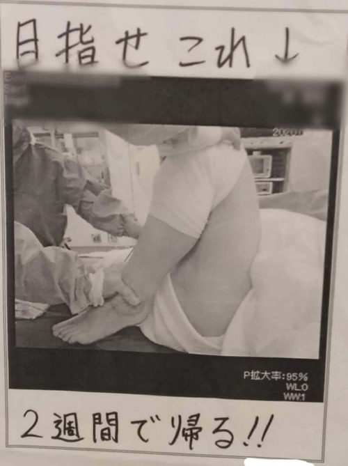 画像に alt 属性が指定されていません。ファイル名: reoperation3-500x669.jpg