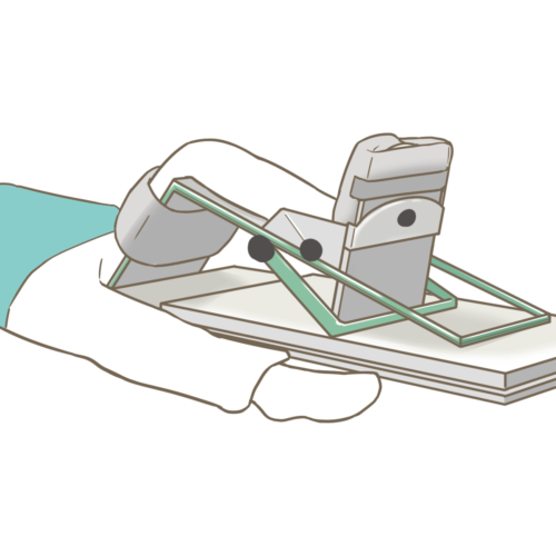 画像に alt 属性が指定されていません。ファイル名: reoperation7-500x500.png